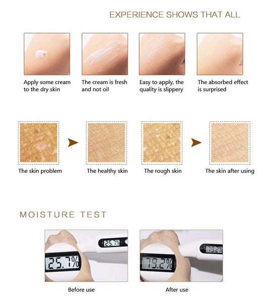 Anti-chapping Lotion