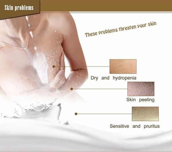 Anti-chapping Lotion